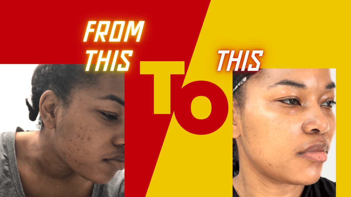 Radiant Skin Journey: The Game-Changing Routine That Transformed My ...