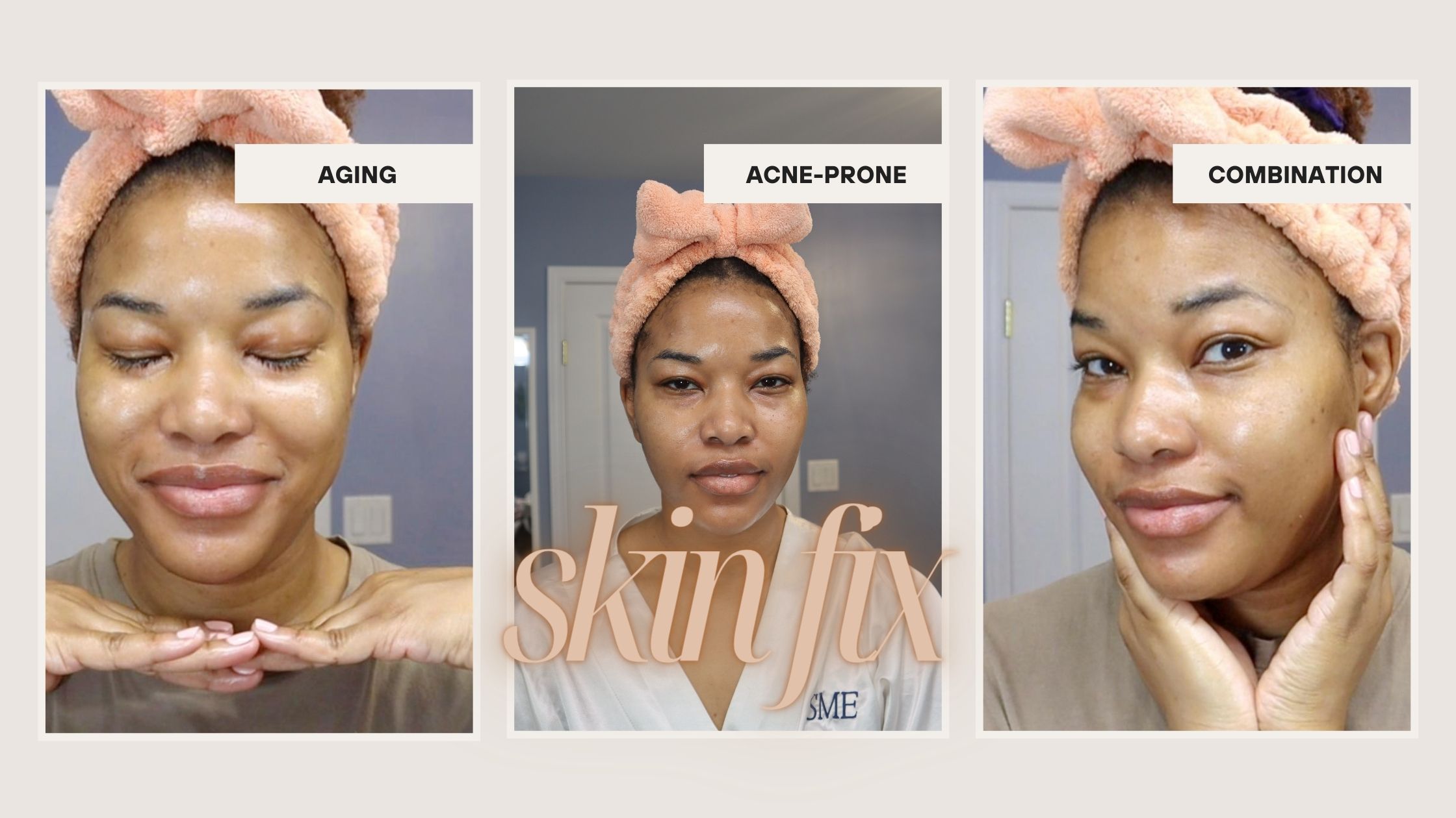 Clear and Radiant: 5 Easy Steps to Manage Aging Acne-Prone Combination Skin